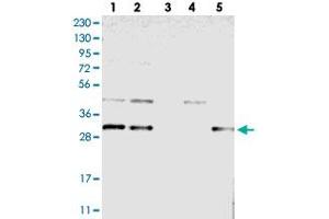 Image no. 2 for anti-Transmembrane Protein 17 (TMEM17) antibody (ABIN5589653)