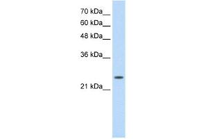 Image no. 1 for anti-Slow Skeletal Troponin I (TNNI1) (N-Term) antibody (ABIN2777151)