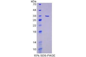 Image no. 1 for Discoidin Domain Receptor tyrosine Kinase 1 (DDR1) (AA 568-829) protein (His tag) (ABIN1879797)