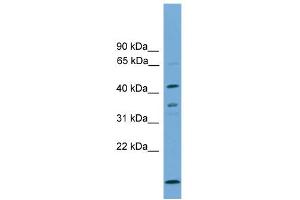 Image no. 1 for anti-Apolipoprotein L, 5 (APOL5) (C-Term) antibody (ABIN2787852)