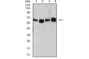Image no. 6 for anti-Carcinoembryonic Antigen-Related Cell Adhesion Molecule 1 (Biliary Glycoprotein) (CEACAM1) (AA 65-201) antibody (ABIN5684132)