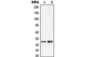 Image no. 2 for anti-serpin Peptidase Inhibitor, Clade A (Alpha-1 Antiproteinase, Antitrypsin), Member 5 (SERPINA5) (Center) antibody (ABIN2706761)