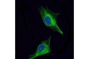 Immunofluorescence analysis of U251 cells using OLIG2 mouse mAb (green).