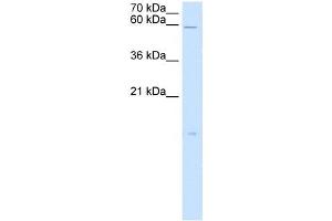 Image no. 3 for anti-Retinoic Acid Receptor Responder (Tazarotene Induced) 3 (RARRES3) antibody (ABIN630298)