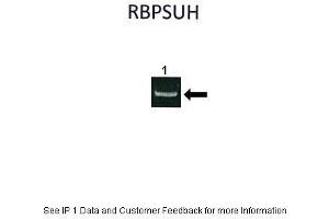 Image no. 4 for anti-Recombination Signal Binding Protein For Immunoglobulin kappa J Region (RBPJ) (C-Term) antibody (ABIN2777213)