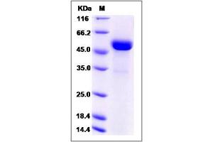 Image no. 1 for ADP-Ribosyltransferase 3 (ART3) (AA 1-362) protein (His tag) (ABIN2005780)