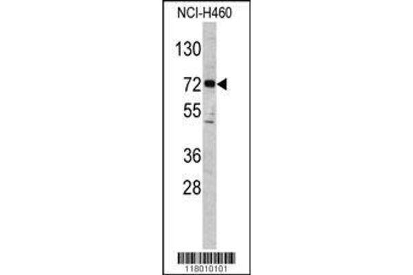 anti-Elongator Acetyltransferase Complex Subunit 2 (ELP2) (AA 737-765), (C-Term) antibody