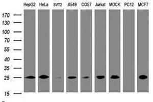 Image no. 3 for anti-Cytidine Monophosphate (UMP-CMP) Kinase 1, Cytosolic (CMPK1) antibody (ABIN1497546)