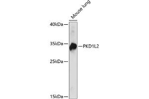 PKD1L2 anticorps  (AA 1-306)