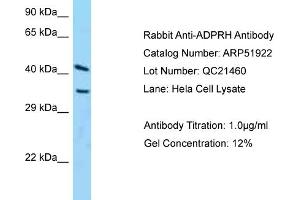 Image no. 1 for anti-ADP-Ribosylarginine Hydrolase (ADPRH) (C-Term) antibody (ABIN2784688)