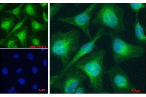 Image no. 1 for anti-Patched 1 (PTCH1) (AA 266-280) antibody (ABIN1590007)