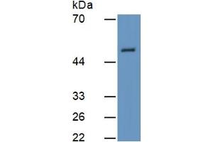 Image no. 5 for Bone Morphogenetic Protein 7 (BMP7) ELISA Kit (ABIN6730953)