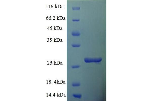 TIMM10B Protein (AA 1-103, full length) (His-SUMO Tag)