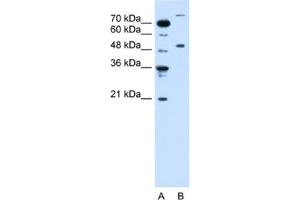 Image no. 1 for anti-Tripartite Motif Containing 42 (TRIM42) antibody (ABIN2462695)