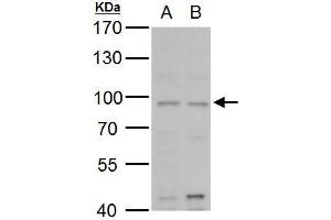 WB Image MLH1 antibody detects MLH1 protein by western blot analysis.
