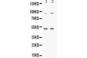 Image no. 2 for anti-Mitogen-Activated Protein Kinase Kinase Kinase 8 (MAP3K8) (AA 9-193) antibody (ABIN4886663)
