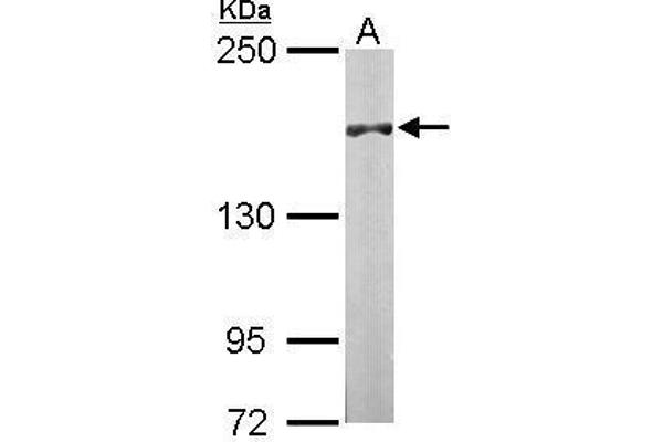 anti-DIP2 Disco-Interacting Protein 2 Homolog B (DIP2B) (C-Term) antibody