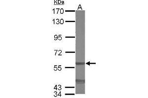 Image no. 3 for anti-Eukaryotic Translation Initiation Factor 3, Subunit D (EIF3D) (Center) antibody (ABIN2855038)