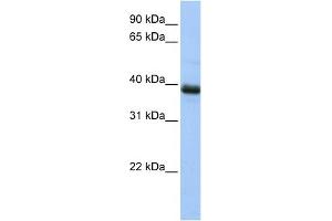 Image no. 2 for anti-SPO11 Meiotic Protein Covalently Bound To DSB Homolog (SPO11) (N-Term) antibody (ABIN2785945)