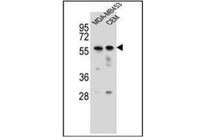 Image no. 1 for anti-Forkhead Box D4 (FOXD4) (AA 189-218), (Middle Region) antibody (ABIN952364)