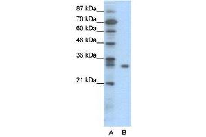 Image no. 2 for anti-NF-kappa-B inhibitor beta (NFKBIB) (N-Term) antibody (ABIN2775762)