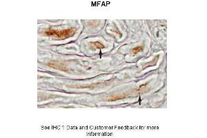 Image no. 2 for anti-Microfibrillar-Associated Protein 4 (MFAP4) (N-Term) antibody (ABIN2776850)