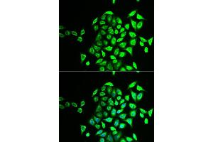 Image no. 2 for anti-N-Ethylmaleimide-Sensitive Factor Attachment Protein, gamma (NAPG) antibody (ABIN2564032)