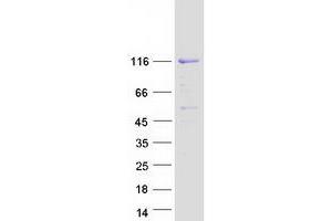 Image no. 1 for Sp3 Transcription Factor (Sp3) (Transcript Variant 1) protein (Myc-DYKDDDDK Tag) (ABIN2732480)