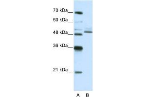 Image no. 2 for anti-Zinc Finger Protein 296 (ZNF296) (C-Term) antibody (ABIN2778483)