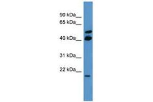Image no. 1 for anti-RAS-Like, Estrogen-Regulated, Growth Inhibitor (RERG) (C-Term) antibody (ABIN6746640)