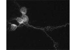 Image no. 1 for anti-Synaptosomal-Associated Protein, 29kDa (SNAP29) (AA 150-200) antibody (ABIN350910)