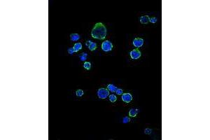 Image no. 2 for anti-CD1a (CD1a) antibody (ABIN969017)
