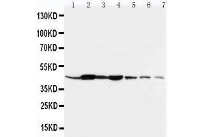 Image no. 7 for anti-Actin, beta (ACTB) (Cytosolic), (N-Term) antibody (ABIN3044484)