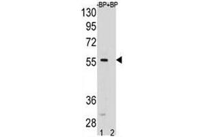 Image no. 2 for anti-SMAD, Mothers Against DPP Homolog 5 (SMAD5) (AA 241-269) antibody (ABIN3029014)