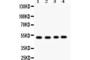 Image no. 1 for anti-Suppressor of Cytokine Signaling 4 (SOCS4) (AA 291-440) antibody (ABIN3043346)