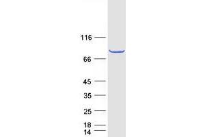Image no. 1 for Papillary Renal Cell Carcinoma (Translocation-Associated) (PRCC) (Transcript Variant 1) protein (Myc-DYKDDDDK Tag) (ABIN2729557)
