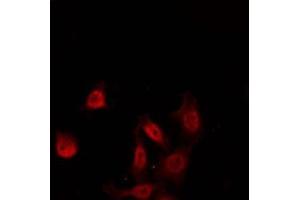 Image no. 4 for anti-Kv Channel Interacting Protein 3, Calsenilin (KCNIP3) (Internal Region) antibody (ABIN6260422)