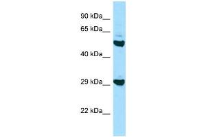 Image no. 1 for anti-Major Histocompatibility Complex, Class II, DO beta (HLA-DOB) (N-Term) antibody (ABIN2788876)