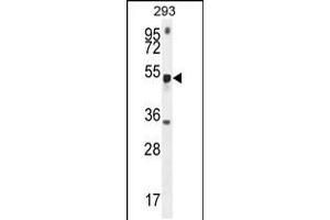 Image no. 1 for anti-Methyltransferase Like 4 (METTL4) (AA 315-344), (C-Term) antibody (ABIN5538187)