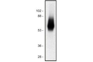 Image no. 1 for anti-T Cell Receptor Associated Transmembrane Adaptor 1 (TRAT1) (AA 29-186) antibody (ABIN94489)