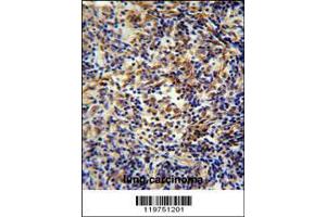 Image no. 1 for anti-CASK Interacting Protein 2 (CASKIN2) (AA 714-741) antibody (ABIN654902)