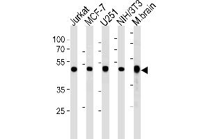 Western Blotting (WB) image for anti-Enolase 1 (ENO1) antibody (ABIN2158698)