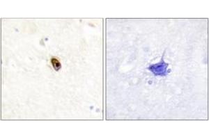 Immunohistochemistry analysis of paraffin-embedded human brain, using AurB/C (Phospho-Thr236/202) Antibody.