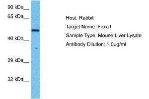 Image no. 3 for anti-Forkhead Box A1 (FOXA1) (C-Term) antibody (ABIN2779762)