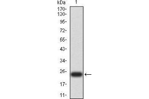 Image no. 1 for anti-Uncoupling Protein 3 (Mitochondrial, Proton Carrier) (UCP3) (AA 1-113) antibody (ABIN5542343)