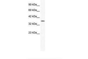 Image no. 2 for anti-Y Box Binding Protein 2 (YBX2) (AA 178-227) antibody (ABIN202349)