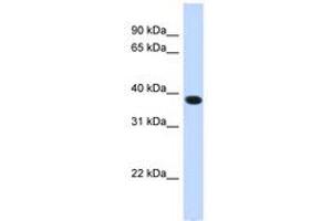 Image no. 1 for anti-Acyl-CoA Binding Domain Containing 4 (ACBD4) (N-Term) antibody (ABIN6741068)