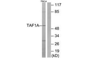 Image no. 1 for anti-TATA Box Binding Protein (TBP)-Associated Factor, RNA Polymerase I, A, 48kDa (TAF1A) (AA 301-350) antibody (ABIN1533914)