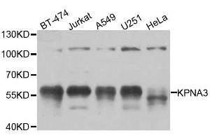 Image no. 2 for anti-Karyopherin alpha 3 (Importin alpha 4) (KPNA3) antibody (ABIN6142991)