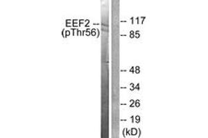 Western blot analysis of extracts from NIH-3T3 cells treated with Serum 10% 30', using eEF2 (Phospho-Thr56) Antibody.